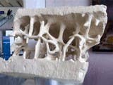 The Next Step for the Future of Osteoporosis (Blog Archive)